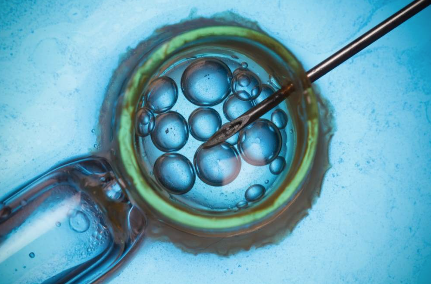 La decisione choc: sì all’impianto dell’embrione anche se l’ex è contrario – I DETTAGLI 1